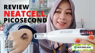 Review NeatCell PICOSECOND Merah dan Biru [upl. by Nirej987]