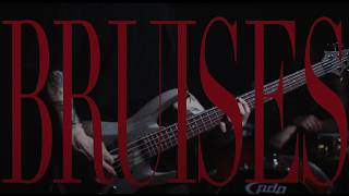 ECHOS  BRUISES OFFICIAL VIDEO [upl. by Atiuqihs]