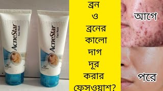 Acne star face wash বাংলা রিভিও  দাম  উপকার  ক্ষতি  ব্যবহারের নিয়ম সবকিছু জেনে নাও  acne [upl. by Ylekalb]