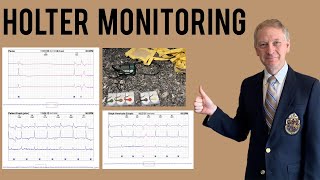 Holter Monitor  Everything you need to know [upl. by Ymaj]