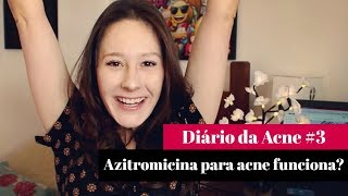 Antibiótico Azitromicina para ACNE  por Letícia Menezes [upl. by Hgieliak]