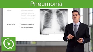 Pneumonia Types Classification Symptoms amp Management  Respiratory Medicine [upl. by Izak]