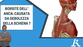 Borsite dellanca causata da debolezza della schiena [upl. by Ainegue]