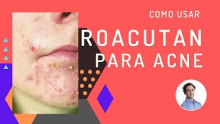 Como usar isotretinoina e roacutan para acne e espinhas [upl. by Wharton]