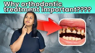 Orthodontic Treatment Tamil [upl. by Annek]