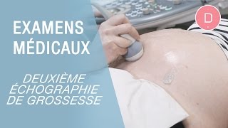 La 2e échographie de grossesse  Examens grossesse [upl. by Ytak]