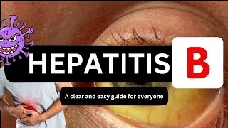 Hepatitis B  Hepatitis B Symptoms  Hepatitis B Tests  Hepatitis B By Dr Shams [upl. by Ayota]