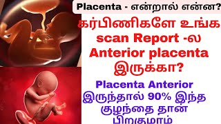 palaceta meaning tamilanterior placentaanterior placenta during pregnancy in tamil [upl. by Hcir]