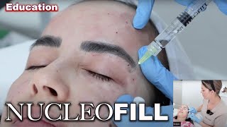 NUCLEOFILL injection techniques full face and eyes 2024 [upl. by Kristofer638]