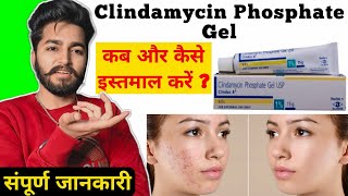 Deriva CMS gel  how to use Adapalene gel  Adapalene gel honest review  Differin  Deriva MS gel [upl. by Elvera]