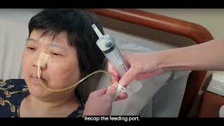 3 Performing Nasogastric Tube NGT Feeding [upl. by Dorrahs814]