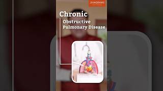 Chronic Obstructive Pulmonary Disease COPD [upl. by Ahcatan]