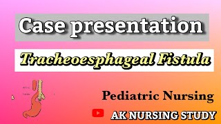 tracheoesophageal fistula case presentation TEF case study in pediatric for TEF [upl. by Galina]