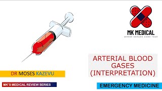 Arterial blood gases  ABGs [upl. by Enrak191]