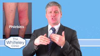 Phlebitis  What is phlebitis and how should phlebitis be treated [upl. by Enaasiali]