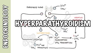 Hyperparathyroidism and the different types causes pathophysiology treatment [upl. by Nautna315]