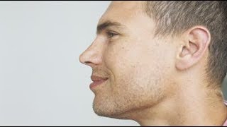 how to get rid of jowls without surgery [upl. by Aramak]