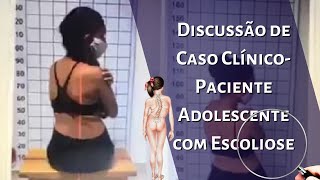 DISCUSSÃƒO DE CASO CLINICO  PACIENTE ADOLESCENTE COM ESCOLIOSE [upl. by Anillehs]