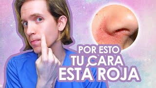 DERMATITIS SEBORREICA Qué es y cómo se trata  Recomendaciones de un dermatologo [upl. by Avert6]