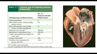 Infective endocarditis  General medicine  DrKarrar Abdulzahra [upl. by Oler217]