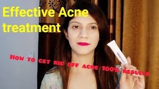 Effective Acne treatment 100 result Arynoin plus gel [upl. by Corabelle]