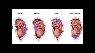 Anterior Placenta means baby Girl or Boy Posterior Placenta means baby Girl or Boy PlacentaPrevia [upl. by Avin]