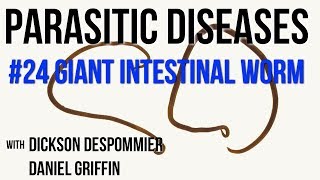 Parasitic Diseases Lectures 24 Giant Intestinal Worm [upl. by Nylecaj427]