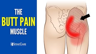 The Butt Pain Muscle How to Release It for INSTANT RELIEF [upl. by Ara706]