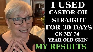 I USED CASTOR OIL FOR 30 DAYS ON MY 74YEAROLD SKIN  MY RESULTS [upl. by Maeve714]