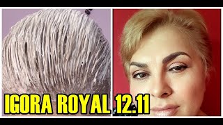 IGORA ROYAL 1211 ESSA É A TINTA QUE USO MO MEU CABELO [upl. by Ecnerret740]