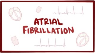 Atrial fibrillation Afib AF  causes symptoms treatment amp pathology [upl. by Maitilde]