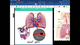 COPD pathology p1 [upl. by Acissj]