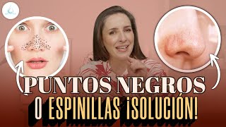 🔴 FILAMENTOS SEBACEOS o PUNTOS NEGROS drapilarochoa  Dermatologa [upl. by Llehsad]