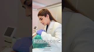 Face Filler Treatment before amp After foryou skintreatment skin lasertreatment cosmeticprocedure [upl. by Elsi]