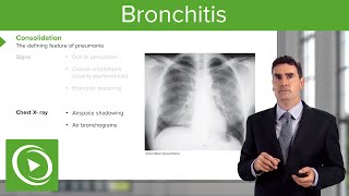 Pneumonia Introduction amp Types – Respiratory Medicine  Lecturio [upl. by Gerg]