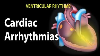 Cardiac Arrhythmias Animation [upl. by Binnings445]