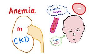 Anemia in Chronic Kidney Disease [upl. by Eimmelc977]