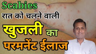 Scabies  Khujli  Itching खुजली का ईलाज [upl. by Danieu]