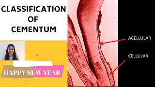 CEMENTUM  PART II II Classification of Cementum [upl. by Inot]