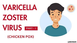 Varicella Zoster virus  Part 1  Made very easy  Medinare [upl. by Donnamarie]