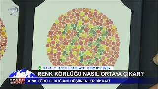 Renk Körlüğü Testi Nedir Renk Körüğü Nasıl Anlaşılır [upl. by Dyl]