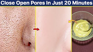 Close open pores on face in just 20 minutes Minimize your large skin pores permanently [upl. by Eenert992]