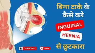 Inguinal Hernia  Signs And Symptoms Explain In Hindi  Dr Ankur Bansal [upl. by Purvis]