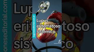 Morbilidad cardiovascular en lupus eritematoso sistémico [upl. by Ikoek]