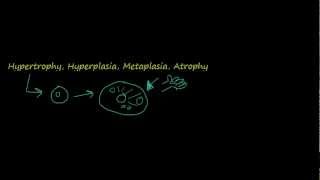 2  Introduction to pathology  hypertrophy hyperplasia [upl. by Phillipp366]