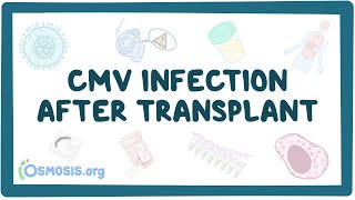 CMV infection after transplant [upl. by Stavro501]