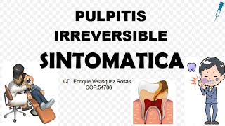 Pulpitis Irreversible Sintomática aguda o subaguda [upl. by Haraj]