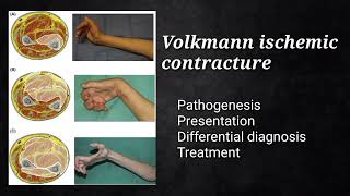 Volkmann ischemic contracture neuroscience neuroanatomy neurology medicalstudent [upl. by Penni]