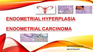 Endometrial Carcinoma amp Endometrial Hyperplasia [upl. by Publus]