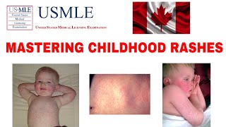 MASTERING CHILDHOOD RASHES MEASLES RUBELLA ROSEOLA SCARLET FEVER USMLE MCC CLINICAL MEDICINE [upl. by Guadalupe]